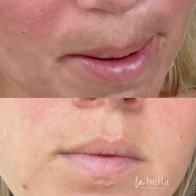 La Bella Skin & Wellness photo 2