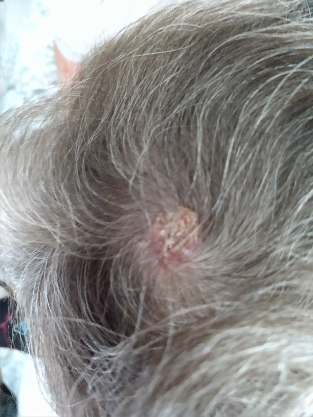 Surgical Dermatology Group - Gadsden photo 2